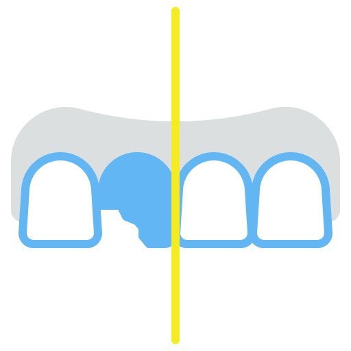 Cosmetic Bonding